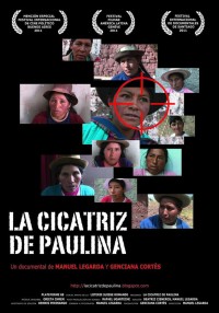 La cicatriz de Paulina (ampliar imagen)